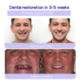 🎁Oferta Flash - ¡No te la pierdas! ODALIT™ Polvo Mineral para Restauración Dental🦷 (Recomendado por TGA)👩‍⚕️ (Trata la periodontitis y las úlceras bucales, previene la pérdida de dientes y repara la recesión de las encías)