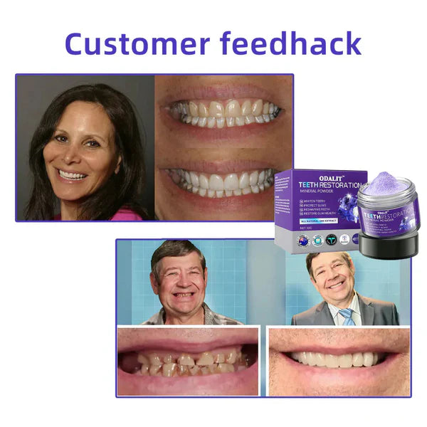 🎁Oferta Flash - ¡No te la pierdas! ODALIT™ Polvo Mineral para Restauración Dental🦷 (Recomendado por TGA)👩‍⚕️ (Trata la periodontitis y las úlceras bucales, previene la pérdida de dientes y repara la recesión de las encías)