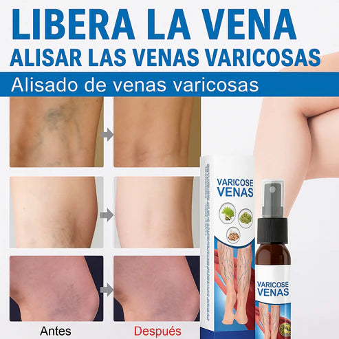 Spray Para Várices - Dale Alivio a tus Piernas + ENVIO GRATIS 🚚