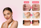 Masajeador Facial Reductor de Papada y Arrugas con Lifting Reafirmante